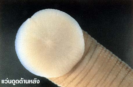 ภาพ : บุญกิจ สุทธิญาณานนท์ คัดลอกมาจาก http://www.sarakadee.com/feature/2003/07/leeches.htm