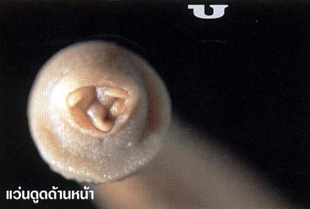 ภาพ : บุญกิจ สุทธิญาณานนท์ คัดลอกมาจาก http://www.sarakadee.com/feature/2003/07/leeches.htm